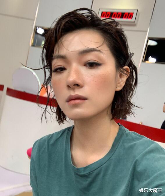 万茜|万茜骨折恢复太快被嘲“医学奇迹”,工作室首度公开手术伤口令人触目惊心