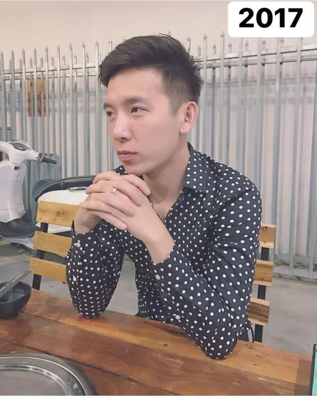 []男子从小就想变成女孩如今花15万改变性别，手术后比女孩还漂亮