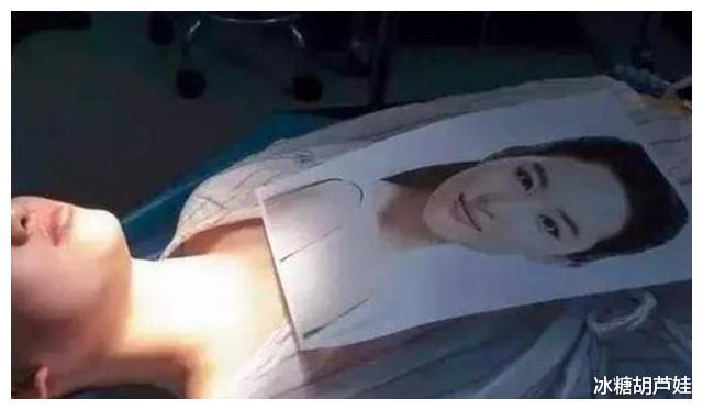 刘亦菲|19岁女生花百万整成刘亦菲，连名字也“高仿”，如今23岁却成这样