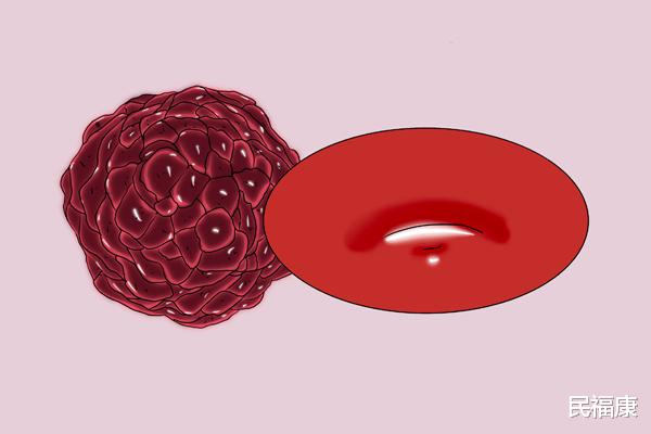 癌细胞|体内有癌看脖子便知？脖子出现哪些异常变化，也许是癌症的先兆？