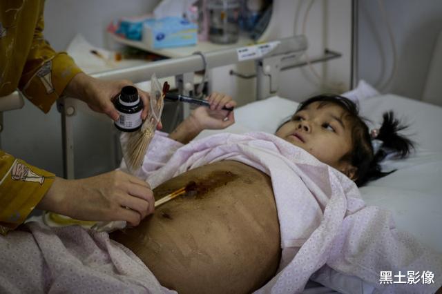 医生|男子捐肝前给妻子“交代后事”，半个月后却在马路上开始指挥交通