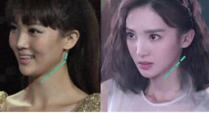 金晨|《隐秘而伟大》金晨脸不对称被质疑整容，额头和山根突兀被吐槽有阿凡达倾向