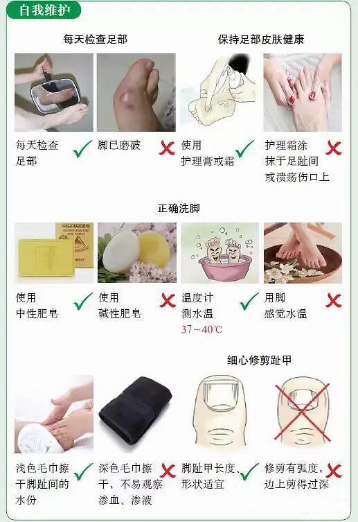 『糖尿病足』糖尿病足的征兆和预防