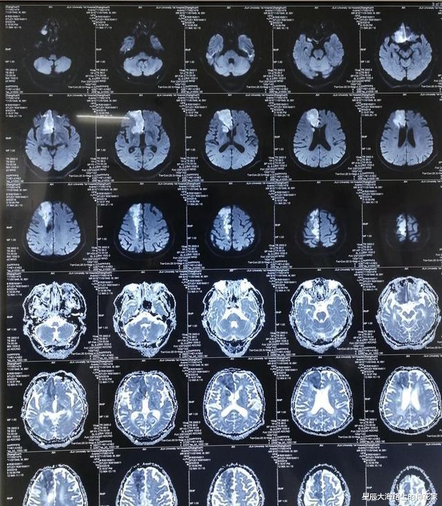 神经元|人死后会去哪里？研究表明：人知道自己死，因为仍会有意识存在！