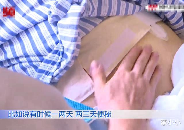 医生|男子三个月没有排便，肠子被粪便快撑爆！医生：从医这么多年从未见过