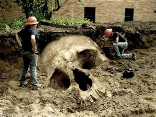 『侏儒症』史上最奇特的男子：前半生是1.37米的侏儒，后半生是2.41米巨人