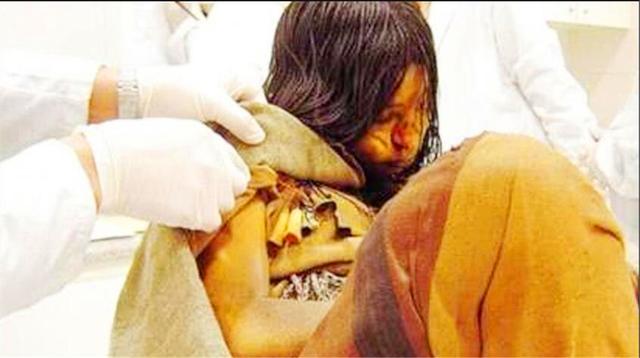 x光@山顶发现16岁少女尸体，已过550年依然完好，X光结果令人瞠目