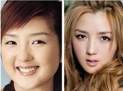 巩俐|十位整容成功前后判若两人的女明星,第五和第八位良心不会痛吗?