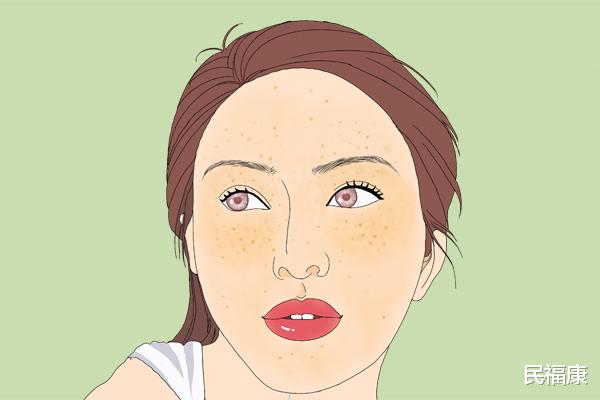 肝脏|肝不好的人和正常人有什么区别？挺明显的，明眼人一下就能看出来