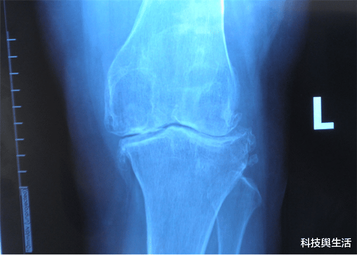 ##人体中消失已久的一大器官，如今再次出现，究竟是好是坏？