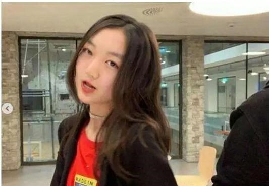 冯小刚|王菲13岁女儿和冯小刚29岁女儿，同患兔唇，如今却有着天壤之别