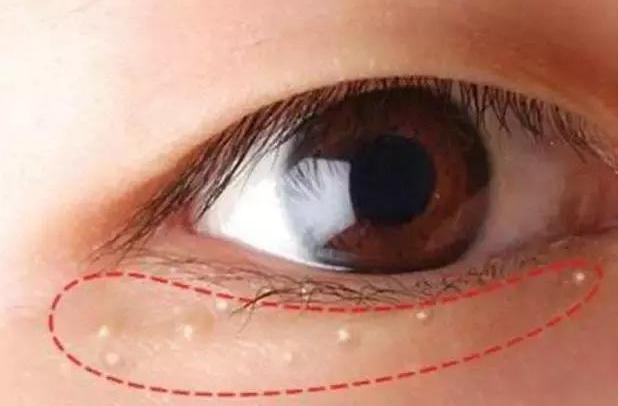 [郭京飞]郭京飞割完眼袋后秒变型男！黑西装造型太有范，对比早前判若两人