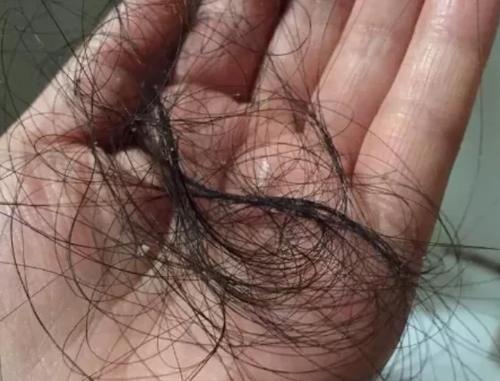 洗发水|脱发真正“凶手”终于找到了，央视曝光的这几种洗发水，你还敢用吗？