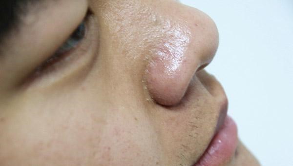 医生|医生惋惜：得了癌，手脚脸等多处部位都有提醒，可惜很多人不在意