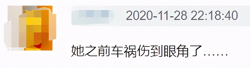 谢娜|谢娜的脸怎么了？笑起来眼角出现奇怪大坑，引网友整容猜疑