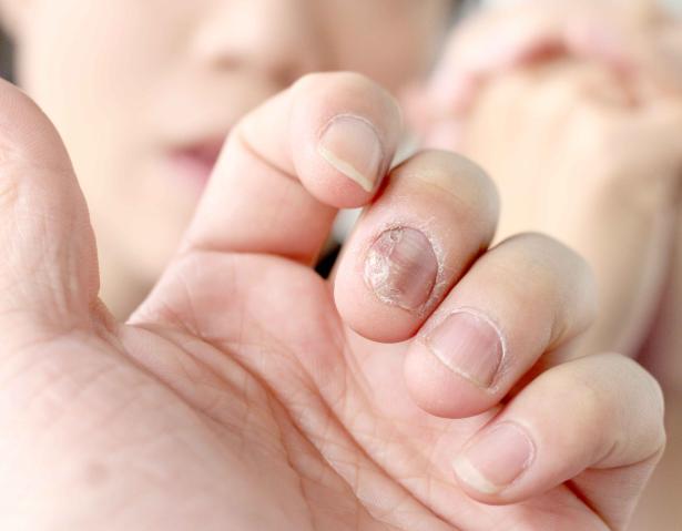 肝脏|肝不好，手知道！手心若有这3种情况，提示你肝脏已出问题了