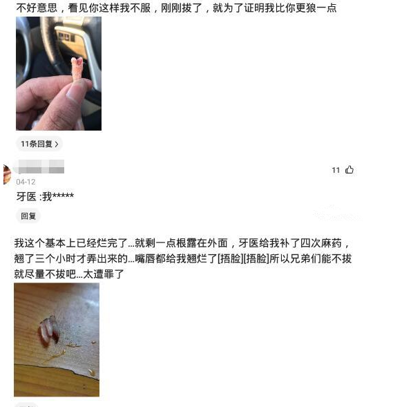 「肾病」“医生说消肿才给拔，半夜起来我就给拔了”结果评论区炸锅了哈哈哈