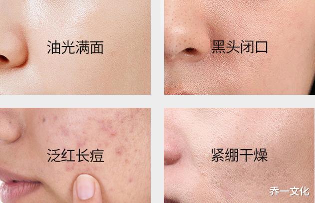 洗面奶|脸上刚“打湿”就涂洗面奶，难怪洗完也出油，皮肤越来越粗糙