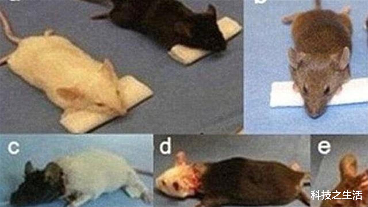 脑死亡|世界首例换头手术在我国进行，实验者是脑死亡患者，如今怎样了？