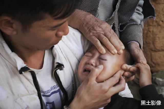 医生|云南一男童眼睛一直往外冒“脏东西”，医生一句话爸爸直接傻眼了