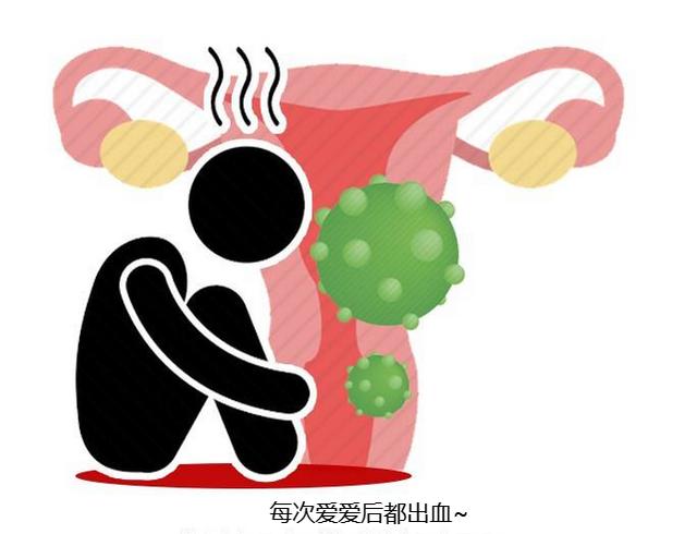 宫颈癌|感染HPV离宫颈癌有多远?腿部一个表现,提示病毒已发生癌变