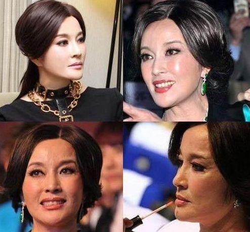 整容|被玻尿酸毁了的六大女星,王心凌像老太太,而她丑到不能接受