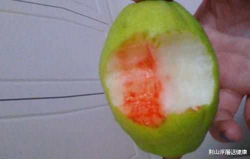 肝脏|晨起4个信号，暗示肝已经“硬如磐石”！一个不占，恭喜肝还不错