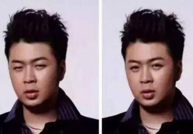 杜海涛▲当明星换上双眼皮,邢昭林自然,张若昀别扭,杜海涛秒变韩国欧巴