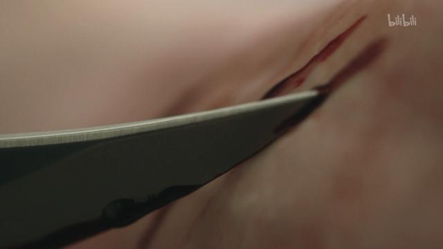 [罗宾]明星死后的尸检，究竟能揭开多少真实到可怕的秘密？