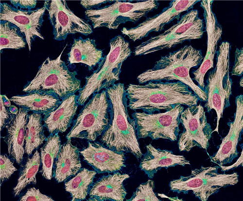 科学家|世上唯一拥有不死细胞的美国女人，细胞能无限增殖，后来结局如何