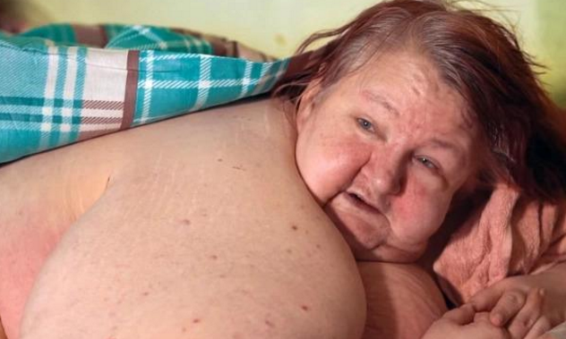 俄羅斯700斤女子孤獨死於傢中，肥肉堆積無法行走，疑患有抑鬱癥-圖3