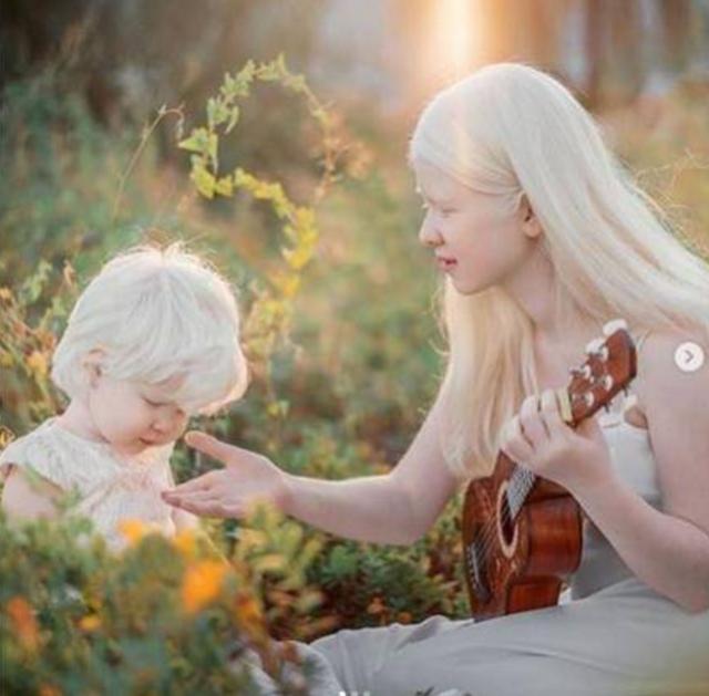 墨语笙歌|姐妹一出生就“没有颜色”，生活中遭备受歧视，如今现状如何