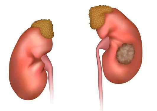 蛋白质▲肾功能“稀烂”的人，3个地方能看出来，瞒不住 ，请及时养肾