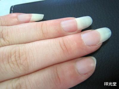 #疾病#血管好不好,手不会骗你!若手上出现此3“异象”,该养血管了