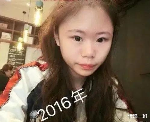 自曝13岁开始整容,3年整容100次,花费超百万