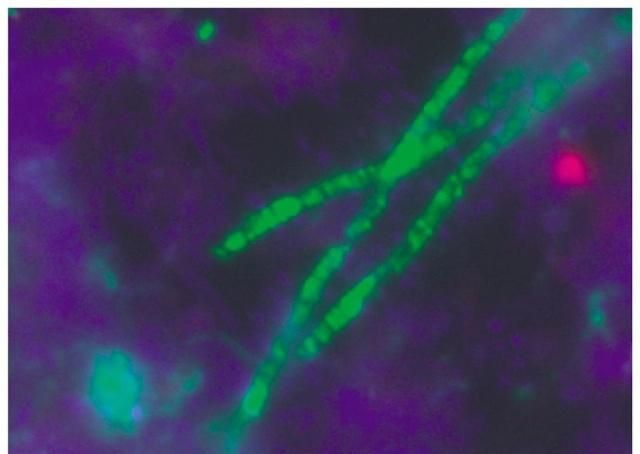 「甲烷」氧气刚出现时几乎杀死了地球上所有的生命！