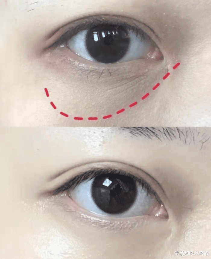 运动|薇娅卸妆暴露真实颜值，素颜还不如普通人？摘掉假睫毛后颜值“平平”