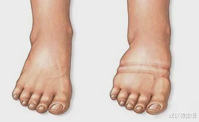 「饮食」肾不好的人,早起后有四种表现,占上一个,三件事要尽早戒掉!