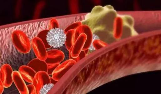 高血脂|高血脂帮凶被发现，医生：少吃2白做3事，坚持1月，胜过降脂药