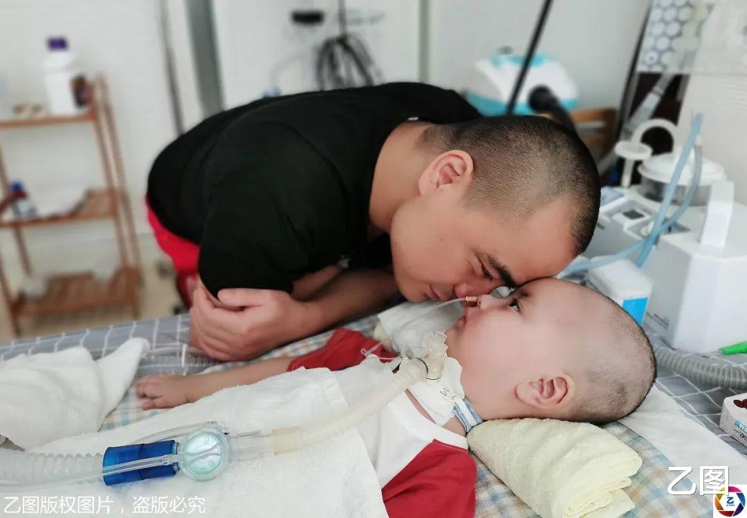 #诺西#一岁大眼男童患罕见病，只有眼珠能动，天价救命药70万元一针