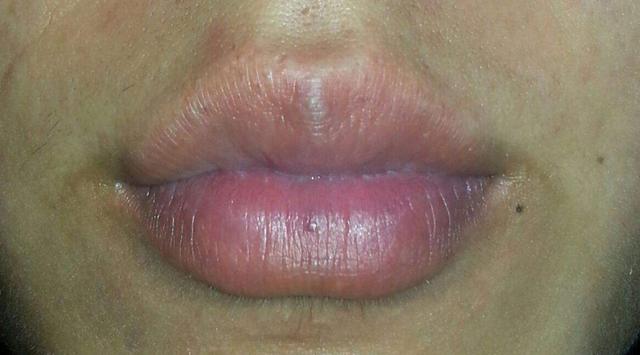 妇科|从女性的嘴巴可以看出,子宫保养的是好是坏,不是专家也能看明白