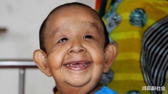 []为什么人类不能近亲结婚？近亲繁殖有什么优缺点，专家告诉你答案！