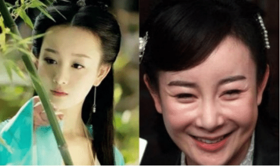 【整容】4位“瞎整容”的女星,前3位很惋惜,最后一位花千万整成怪物