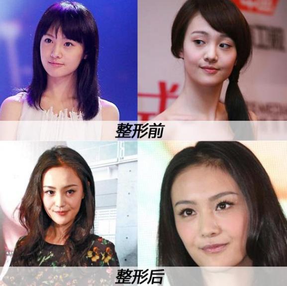 杨紫|继李小璐和杨紫后，又一女明星被拍到去整形医院，唯独她大方承认