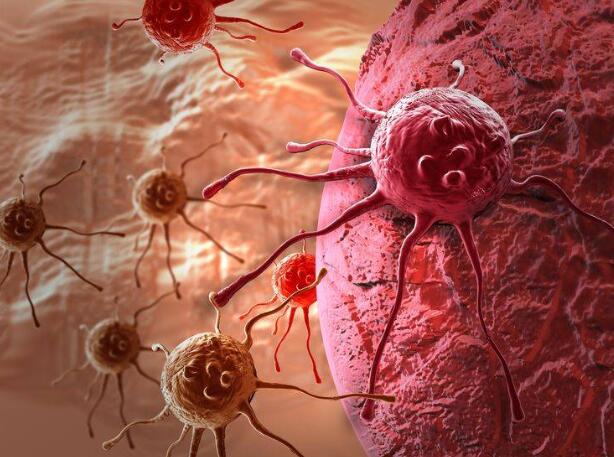 致癌物|癌症的“帮凶”被揪出，患上癌症的人，通常都有四个共同点！