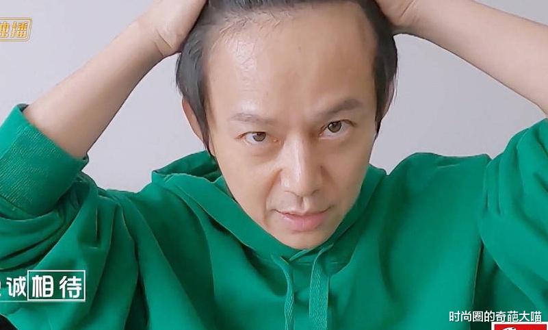 郑爽▲何炅展示发际线 这大脑门和和杨幂有的一拼！明星的发量是个谜
