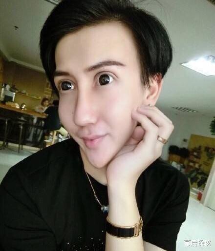 刘梓晨|奇葩长相走天下：前有整容狂魔刘梓晨，后有嘟嘟姐刻意丑化自己