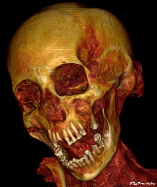 木乃伊|3000年前木乃伊面目狰狞，形似痛苦尖叫，她到底经历了什么？