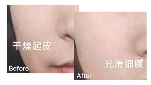 「护肤品」农村一女子每晚用精华液长达3年，现在变成啥样？老公：不敢相认