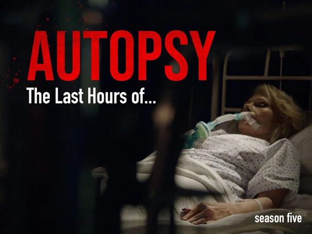 [罗宾]明星死后的尸检，究竟能揭开多少真实到可怕的秘密？